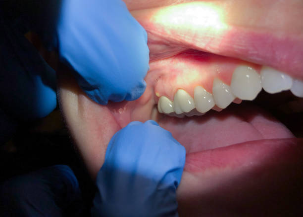 Best Emergency Dental Surgery in Canyonville, OR