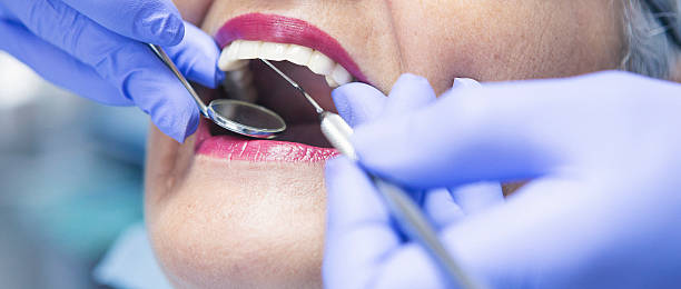 Best Emergency Broken Tooth Repair in Canyonville, OR